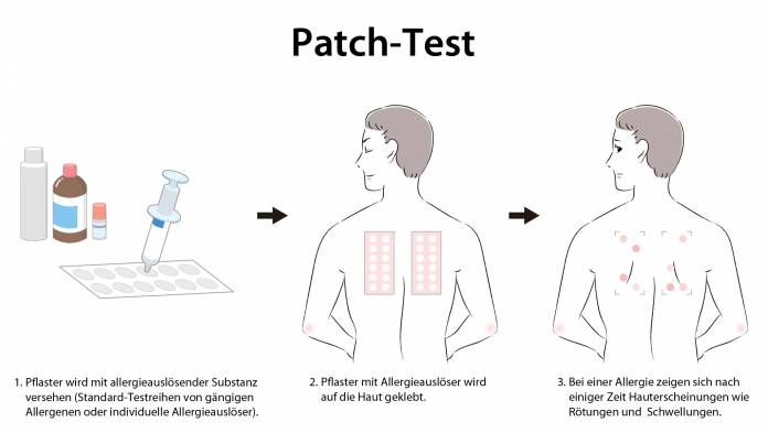 Patch-Test
