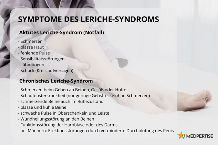 Symptome des Leriche-Syndroms