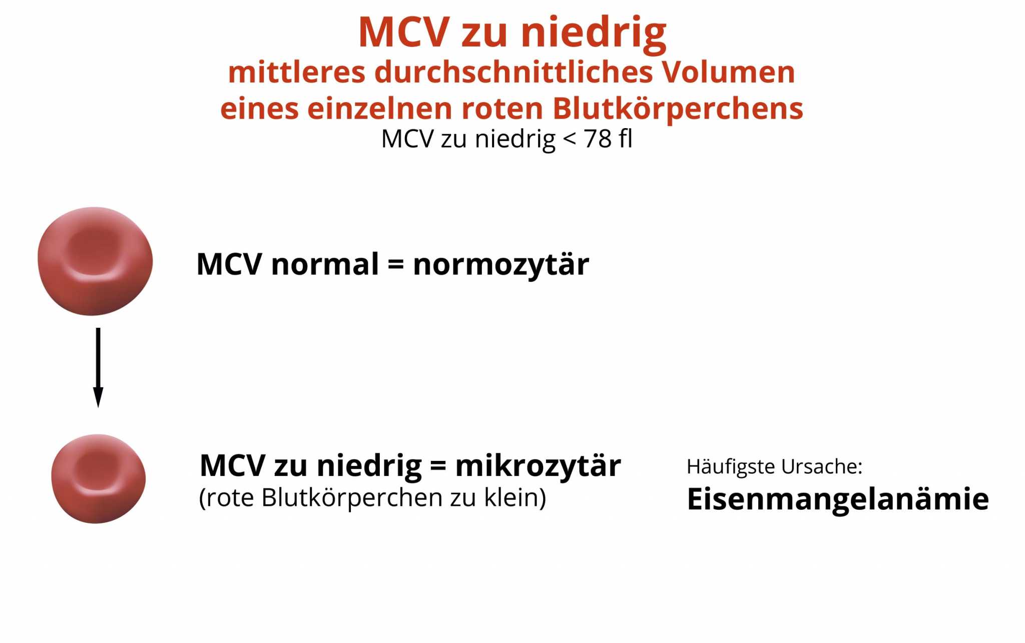 MCV zu niedrig