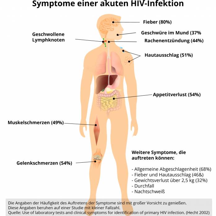 Symptome einer akuten HIV-Infektion