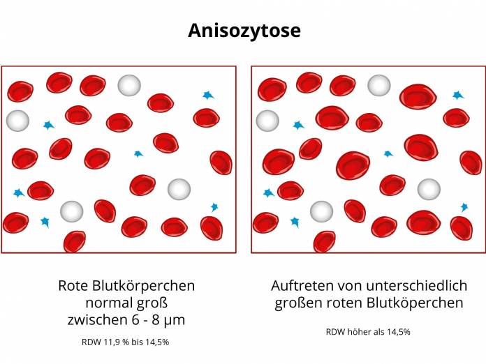Anisozytose