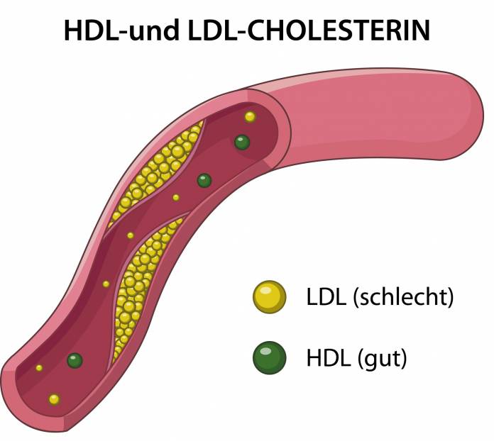 HDL-und LDL-Cholesterin