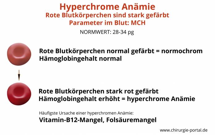 Hyperchrome Anämie