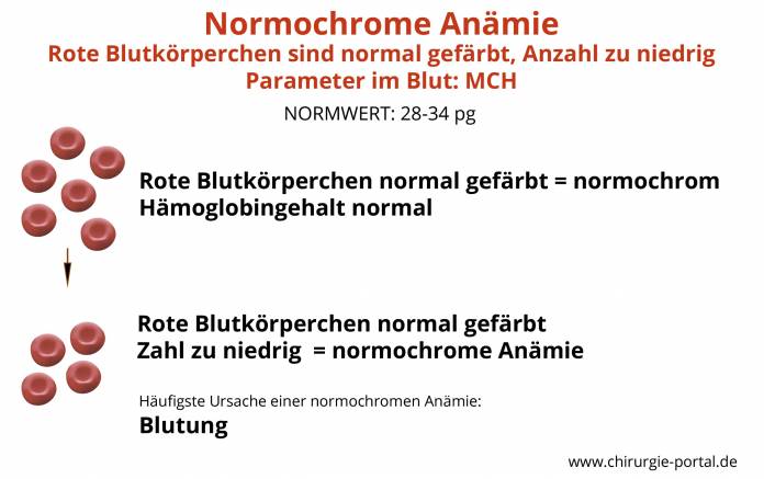 Normochrome Anämie