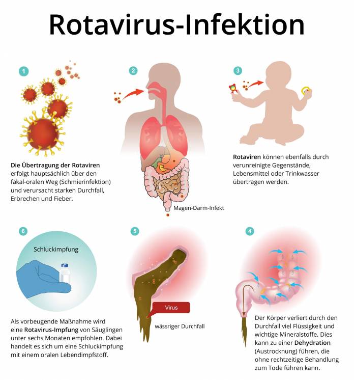 Rotavirus-Infektion