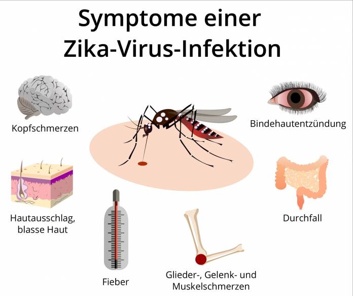 Symptome einer Zika-Virus-Infektion